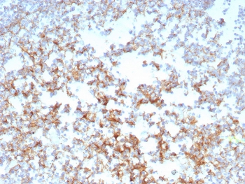 IHC staining of FFPE human tonsil tissue with CD21 antibody (clone CR2/8769R). HIER: boil tissue sections in pH 9 10mM Tris with 1mM EDTA for 20 min and allow to cool before testing.~