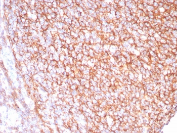 IHC staining of FFPE human tonsil tissue with CD21 antibody (clone CR2/8880R). HIER: boil tissue sections in pH 9 10mM Tris with 1mM EDTA for 20 min and allow to cool before testing.~