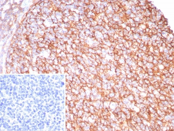 IHC staining of FFPE human tonsil tissue with CD21 anti