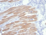 IHC staining of FFPE human heart muscle tissue with recombinant ACTN2 antibody (clone rACTN2/7361). HIER: boil tissue sections in pH 9 10mM Tris with 1mM EDTA for 20 min and allow to cool before testing.