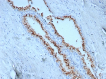 IHC staining of FFPE human prostate tissue with Prostein antibody (clone SLC45A3/7650). HIER: boil tissue sections in pH 9 10mM Tris with 1mM EDTA for 20 min and allow to cool before testing.~