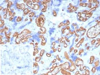 IHC staining of FFPE human placental tissue with CD34 antibody (clone CD34/7721) at 2ug/ml. Inset: PBS used in place of primary Ab (secondary Ab negative control). HIER: boil tissue sections in pH 9 10mM Tris with 1mM EDTA for 20 min and allow to cool before testing.~