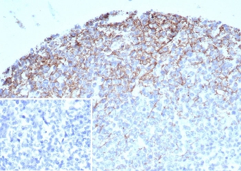 IHC staining of FFPE human tonsil tissue with CD35 antibody (clone CR1/7108) at 2ug/ml. Inset: PBS used in place of primary Ab (secondary Ab negative control). HIER: boil tissue sections in pH 9 10mM Tris with 1mM EDTA for 20 min and allow to cool before testing.~