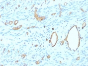 IHC staining of FFPE human uterus tissue with recombinant CD34 antibody (clone rHPCA1/8500). HIER: boil tissue sections in pH 9 10mM Tris with 1mM EDTA for 20 min and allow to cool before testing.