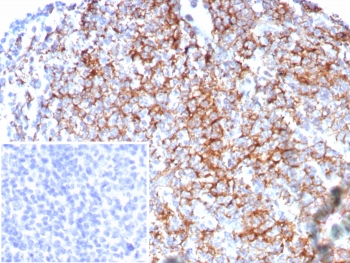 IHC staining of FFPE human tonsil tissue with CD35 antibody (clone rCR1/8596). Inset: PBS used in place of primary Ab (secondary Ab negative control). HIER: boil tissue sections in pH 9 10mM Tris with 1mM EDTA for 20 min and allow to cool before testing.~