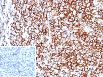 IHC staining of FFPE human tonsil tissue with CD35 antibody (clone rCR1/8597). Inset: PBS used in place of primary Ab (secondary Ab negative control). HIER: boil tissue sections in pH 9 10mM Tris with 1mM EDTA for 20 min and allow to cool before testing.~