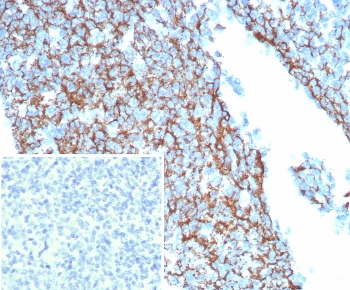 IHC staining of FFPE human tonsil tissue with CD35 antibody (clone CR1/8244R). Inset: PBS used in place of primary Ab (secondary Ab negative control). HIER: boil tissue sections in pH 9 10mM Tris with 1mM EDTA for 20 min and allow to cool before testing.~