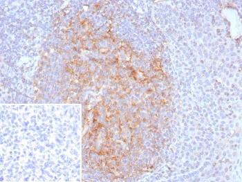 IHC staining of FFPE human tonsil tissue with CD35 antibody (clone CR1/8223R). Inset: PBS used in place of primary Ab (secondary Ab negative control). HIER: boil tissue sections in pH 9 10mM Tris with 1mM EDTA for 20 min and allow to cool before testing.~