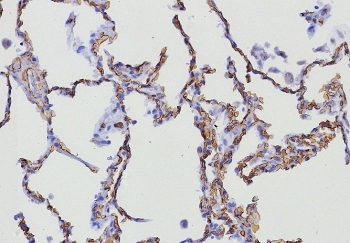 IHC staining of FFPE human lung tissue with CD34 anti