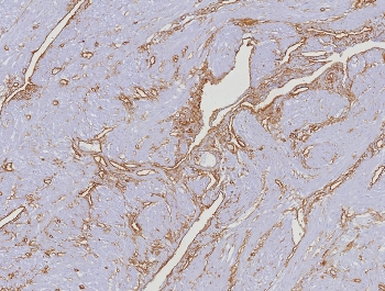 IHC staining of FFPE human uterus tissue with CD34 an