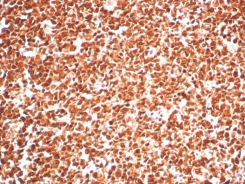 IHC staining of FFPE human tonsil tissue with Proliferating Cell Nuclear Antigen antibody (clone PCNA/8303R). HIER: boil tissue sections in pH 9 10mM Tris with 1mM EDTA for 20 min and allow to cool before testing.~