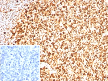 IHC staining of FFPE human tonsil tissue with PCNA antibody (clone PCNA/8633R). Inset: PBS used in place of primary Ab (secondary Ab negative control). HIER: boil tissue sections in pH 9 10mM Tris with 1mM EDTA for 20 min and allow to cool before testing.~