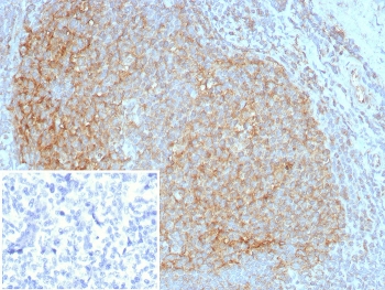 IHC staining of FFPE human tonsil tissue with CD35 antibody (clone CR1/8283R). Inset: PBS used in place of primary Ab (secondary Ab negative control). HIER: boil tissue sections in pH 9 10mM Tris with 1mM EDTA for 20 min and allow to cool before testing.~