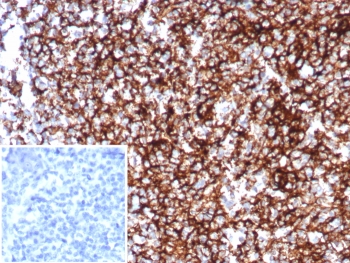 IHC staining of FFPE human tonsil tissue with CD35 antibody (clone CR1/8598R). Inset: PBS used in place of primary Ab (secondary Ab negative control). HIER: boil tissue sections in pH 9 10mM Tris with 1mM EDTA for 20 min and allow to cool before testing.~