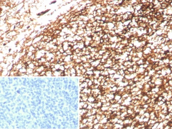 IHC staining of FFPE human tonsil tissue with Complement receptor 1 antibody (clone CD35/8833R). Inset: PBS used in place of primary Ab (secondary Ab negative control). HIER: boil tissue sections in pH 9 10mM Tris with 1mM EDTA for 20 min and allow to cool before testing.~