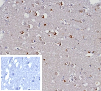 IHC staining of FFPE human brain tissue with KCNJ6 antibody (clone KCNJ6/7557) at 2ug/ml. Inset: PBS used in place of primary Ab (secondary Ab negative control). HIER: boil tissue sections in pH 9 10mM Tris with 1mM EDTA for 20 min and allow to cool before testing.~