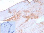 IHC staining of FFPE human skeletal muscle tissue with ACTN2 antibody (clone rACTN2/8177). Inset: PBS used in place of primary Ab (secondary Ab negative control). HIER: boil tissue sections in pH 9 10mM Tris with 1mM EDTA for 20 min and allow to cool before testing.