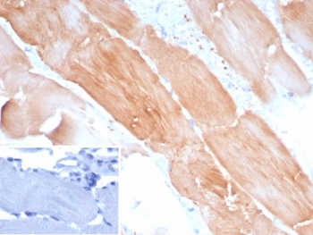 IHC staining of FFPE human skeletal muscle tissue with ACTN2 antibody (clone ACTN2/8184R). Inset: PBS used in place of primary Ab (secondary Ab negative control). HIER: boil tissue sections in pH 9 10mM Tris with 1mM EDTA for 20 min and allow to cool before testing.~