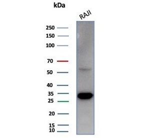 Western blot testing of human Raji cell lysate with PCNA antibody (clone PCNA/4540). Predicted molecular weight ~29 kDa, routinely observed at 29~36 kDa.~