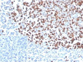 IHC staining of FFPE human tonsil tissue with PCNA antibody (clone PCNA/4540) at 2ug