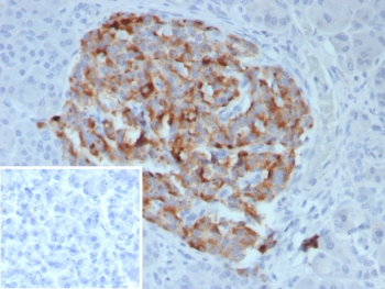 IHC staining of FFPE human pancreas tissue with Chromogranin B antibody (clone CHGB/7756). Inset: PBS used in place of primary Ab (secondary Ab negative control). HIER: boil tissue sections in pH 9 10mM Tris with 1mM EDTA for 20 min and allow to cool before testing.~