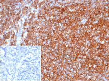 IHC staining of FFPE human tonsil tissue with CD40 a