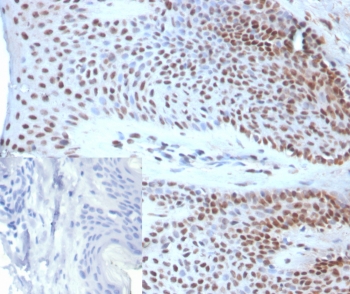 IHC staining of FFPE human skin tissue with SOX18 antibody (clone SOX18/3271). Inset: PBS used in place of primary Ab (secondary Ab negative control). HIER: boil tissue sections in pH 9 10mM Tris with 1mM EDTA for 20 min and allow to cool before testing.~