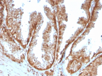 IHC staining of FFPE human prostate tissue with SOD1 antibody (clone SOD1/4593). HIER: boil tissue sections in pH 9 10mM Tris with 1mM EDTA for 20 min and allow to cool before testing.~