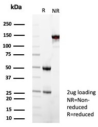 SDS-PAGE analysis of purified, BSA-free SOD1 antibody