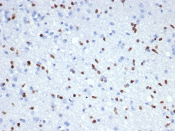 IHC staining of FFPE human brain tissue (RNA expression: 54.2 nTPM) with OLIG2 antibody (clone OLIG2/7366R). HIER: boil tissue sections in pH 9 10mM Tris with 1mM EDTA for 20 min and allow to cool before testing.~