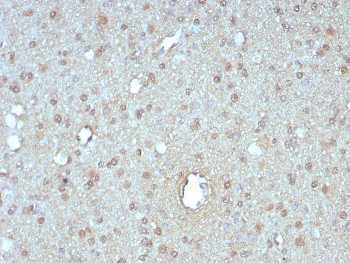 IHC staining of FFPE human pancreas tissue with GIRK2 antibody (clone KCNJ6/7558) at 2ug/ml. HIER: boil tissue sections in pH 9 10mM Tris with 1mM EDTA for 20 min and allow to cool before testing.~