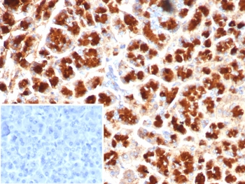 IHC staining of FFPE human pancreas tissu