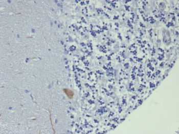 IHC staining of FFPE human brain tissue with GIRK2 antibody (clone KCNJ6/7559) at 2ug/ml. HIER: boil tissue sections in pH 9 10mM Tris with 1mM EDTA for 20 min and allow to cool before testing.~