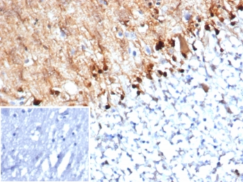 IHC staining of FFPE human brain tissue with S100B antibody (clone S100B/4152) at 2ug/ml. Inset: PBS used in place of primary Ab (secondary Ab negative control). HIER: boil tissue sections in pH 9 10mM Tris with 1mM EDTA for 20 min and allow to cool before testing.~