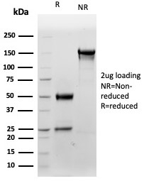 SDS-PAGE analysis of purified, BSA-free S100B antibody (clone S100B/4159) as con