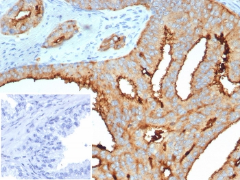 IHC staining of FFPE human prostate tissue with Transmembrane protease serine 2 antibody (clone TMPRSS2/7420). HIER: boil tissue sections in pH 9 10mM Tris with 1mM EDTA for 20 min and allow to cool before testing.~