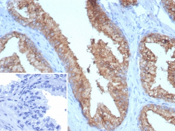 IHC staining of FFPE human prostate tissue with TMPRSS2 antibody (clone TMPRSS2/7410). Inset: PBS used in place of primary Ab (secondary Ab negative control). HIER: boil tissue sections in pH 9 10mM Tris with 1mM EDTA for 20 min and allow to cool before testing.~