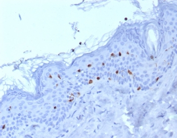 IHC staining of FFPE human skin tissue with Langerin