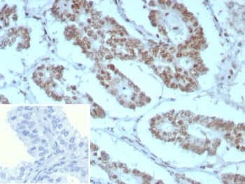 IHC staining of FFPE human prostate tissue with BAF4