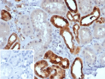 IHC staining of FFPE human kidney tissue with PVALB antibody (clone PVALB/7601). Inset: PBS used in place of primary Ab (secondary Ab negative control). HIER: boil tissue sections in pH 9 10mM Tris with 1mM EDTA for 20 min and allow to cool before testing.~