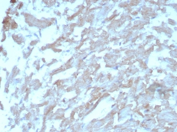 IHC staining of FFPE human heart tissue with FABP3 antibody (clone FABP3/8442). HIER: boil tissue sections in pH 9 10mM Tris with 1mM EDTA for 20 min and allow to cool before testing.~