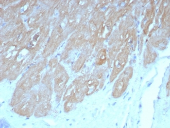 IHC staining of FFPE human heart tissue with FABP3 antibody (clone FABP3/8440). HIER: boil tissue sections in pH 9 10mM Tris with 1mM EDTA for 20 min and allow to cool before testing.~