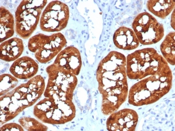 IHC staining of FFPE human kidney tissue with FABP1 antibody (clone FABP1/4990). HIER: boil tissue sections in pH 9 10mM Tris with 1mM EDTA for 20 min and allow to cool before testing.~