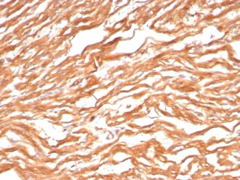 IHC staining of FFPE human heart tissue with FABP3 antibody (clone FABP3/8443). HIER: boil tissue sections in pH 9 10mM Tris with 1mM EDTA for 20 min and allow to cool before testing.~