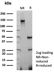 SDS-PAGE analysis of purified, BSA-free FABP3 antibody