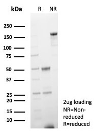 SDS-PAGE analysis of purified, BSA-free FABP3 antibod