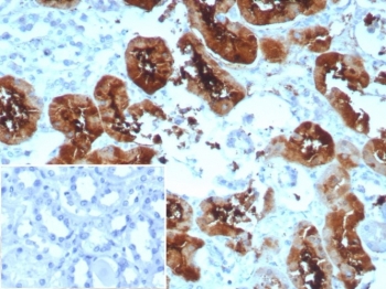 IHC staining of FFPE human kidney tissue with recombinant FABP1 antibody (clone rFABP1/8520). Inset: PBS used in place of primary Ab (secondary Ab negative control). HIER: boil tissue sections in pH 9 10mM Tris with 1mM EDTA for 20 min and allow to cool before testing.~