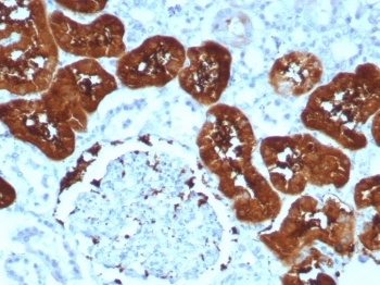 IHC staining of FFPE human kidney tissue with Fatty Acid Binding Protein 1 antibody (clone FABP1/8521R). HIER: boil tissue sections in pH 9 10mM Tris with 1mM EDTA for 20 min and allow to cool before testing.~
