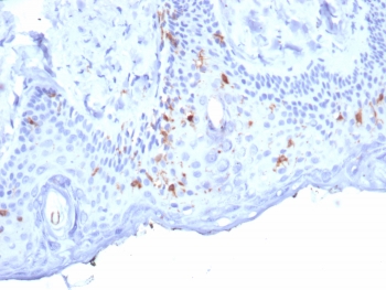 IHC staining of FFPE human skin tissue with Langerin antibody (clone LGRN/7357). HIER: boil tissue sections in pH 9 10mM Tris with 1mM EDTA for 20 min and allow to cool before testing.~