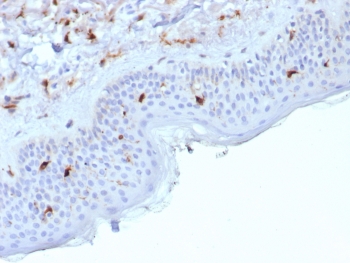IHC staining of FFPE human skin tissue with Langerin antibody (clone LGRN/7429). HIER: boil tissue sections in pH 9 10mM Tris with 1mM EDTA for 20 min and allow to cool before testing.~